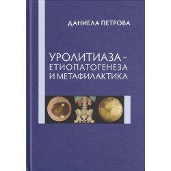 Уролитиаза - Етиопатогенеза и метафилактика